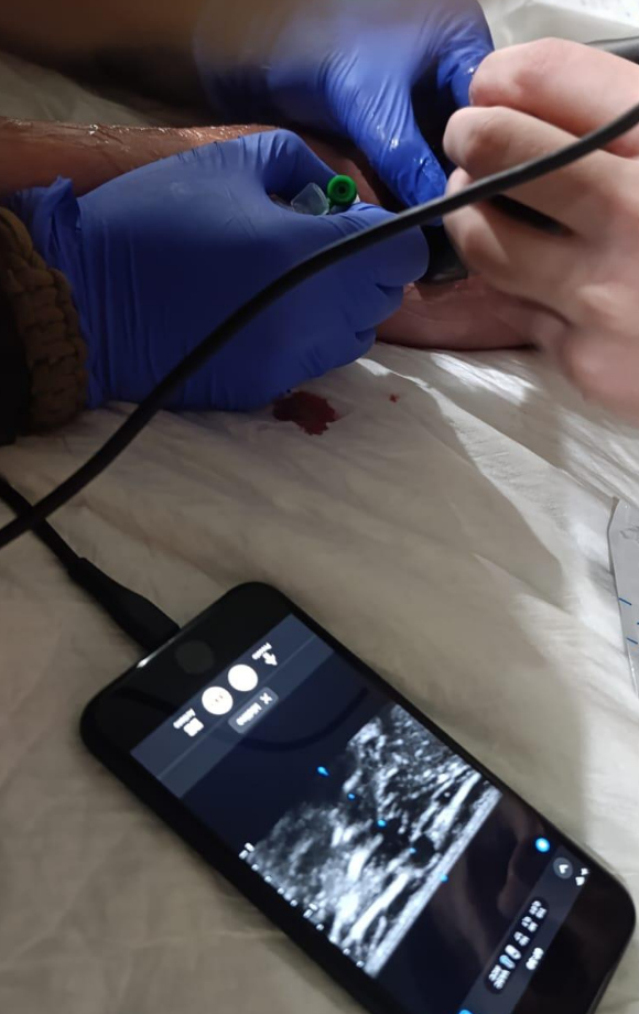 Arts in Kharkiv met een draagbaar echoapparaat gekoppeld aan een telefoon.